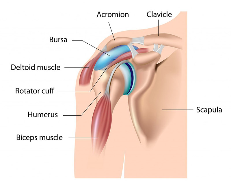 Bohsali shoulder impingement