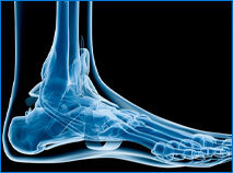 Image of an ankle with an X-Ray view.