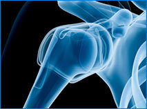 JOI and JOI Rehab treat all types of shoulder injuries and pain. Please call JOI-2000