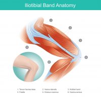 The IT band can get tight and cause anterior knee pain.