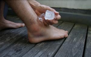 Syndesmosis Sprain injury should be iced during first days after injury