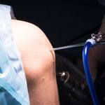 Arthroscopic surgery or arthroscopy is used to perform small repairs, debridement, and as a diagnostic procedure. 