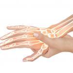 There are many possible reasons behind pain in the hand. One reason can be due to a hand fracture.