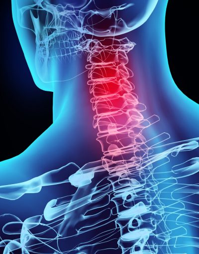 The Neck or Cervical Spint