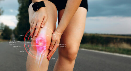 4 Knee Pain Remedies
