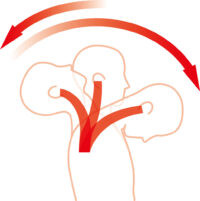 Whiplash Injuries
