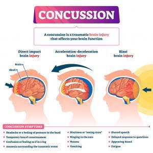 concussions may bring about lifestyle changes.