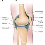 Knee anatomy is affected by knee pain. 