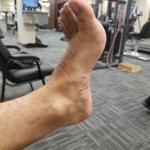 image of Ankle physical therapy Dorsiflexion exercise