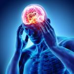image of brain concussion