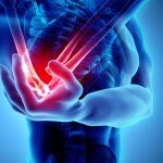 Elbow injuries in youth athletics