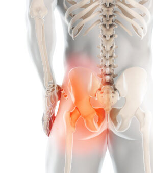 Snapping Hip Syndrome JOI Rehab