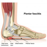 Anatomy of the foot and plantar fascia.