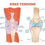 The many tendons and ligaments in the knee where ACL Tears occur