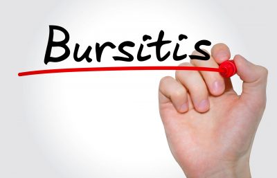 Bursitis of the hip by JOI Rehab
