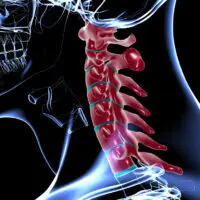 The neck bones are highlighted in red to show the cervical vertebrae at the upper portion of the spine. JOI Rehab