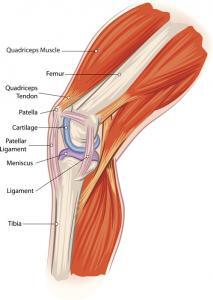 Osgood-schlatter disease is a large bump on the tibia usually occuring in children.