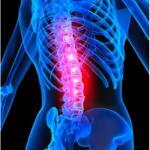 JOI Treats Scoliosis and Back Pain