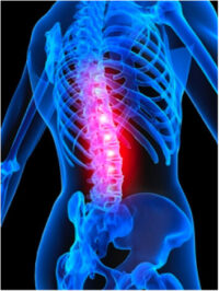 JOI Treats Back Pain