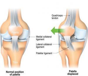 Knee dislocations are an injury treated by orthopaedic physicians.