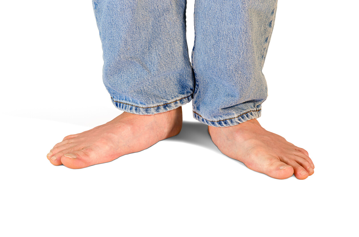 Why Are Flat Feet A Problem JOI Jacksonville Orthopaedic Institute