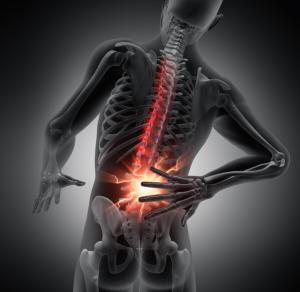Arthritis of the spine can cause back pain