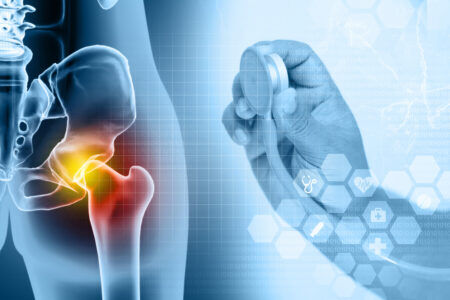 Hip Pain Diagnosis from JOI