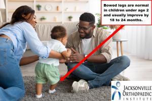 Image of an African American family with a bow legged baby without Blount's Disease. JOI Rehab