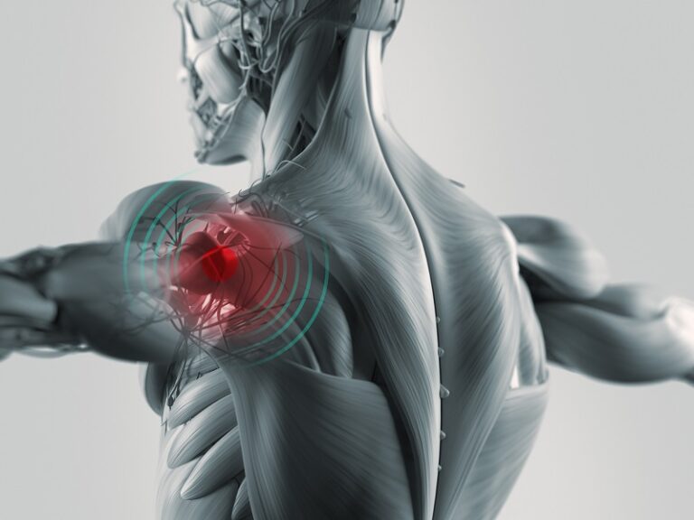 shoulder arthroscopy
