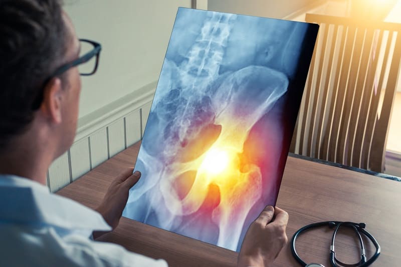 hip dysplasia treatment