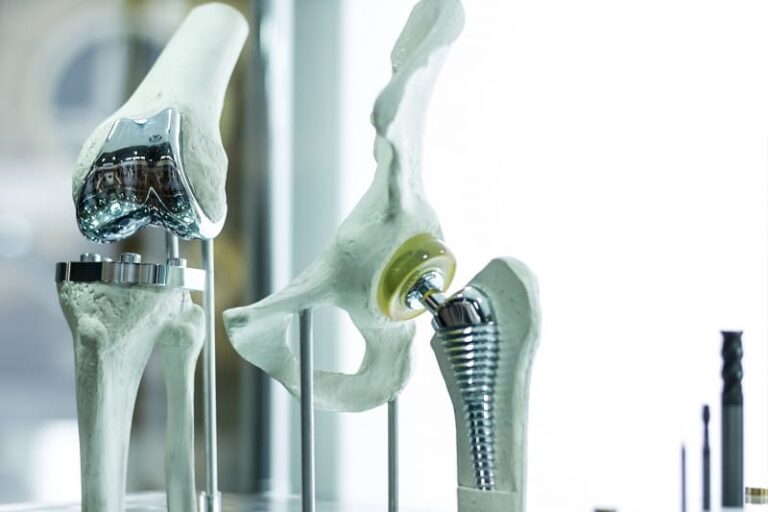 knee replacement surgery
