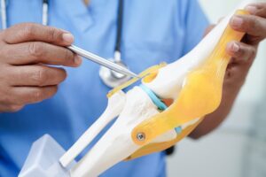 How Long Do Joint Replacements Really Last