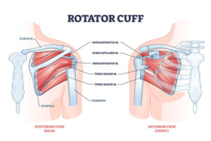 shoulder injury