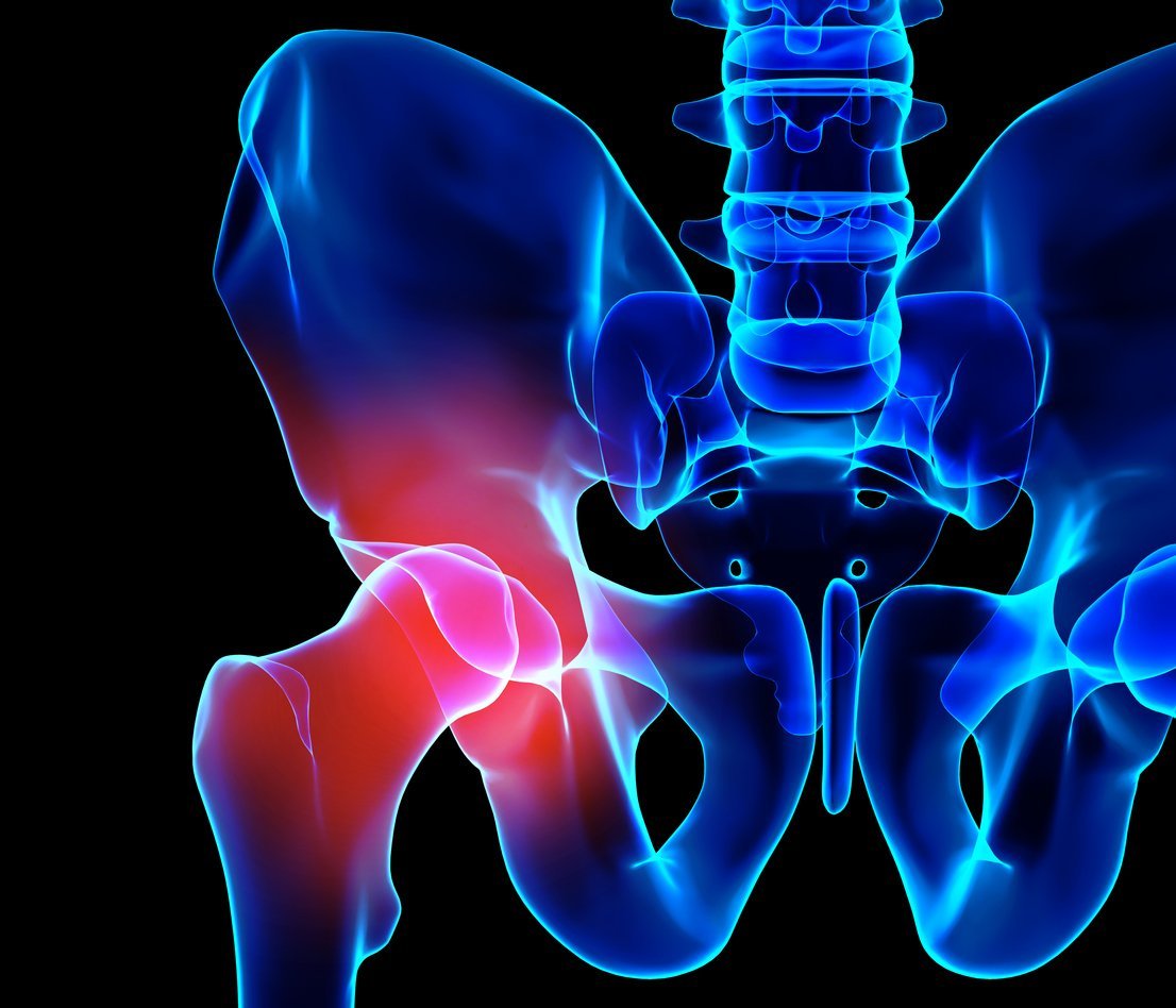JOI has identified 5 hip symptoms that you should not ignore, Hip Pain Symptoms
