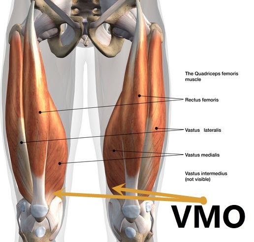 Anatomical diagram of the VMO or vastus medialis oblique with arrows and labels to the components of the quadriceps