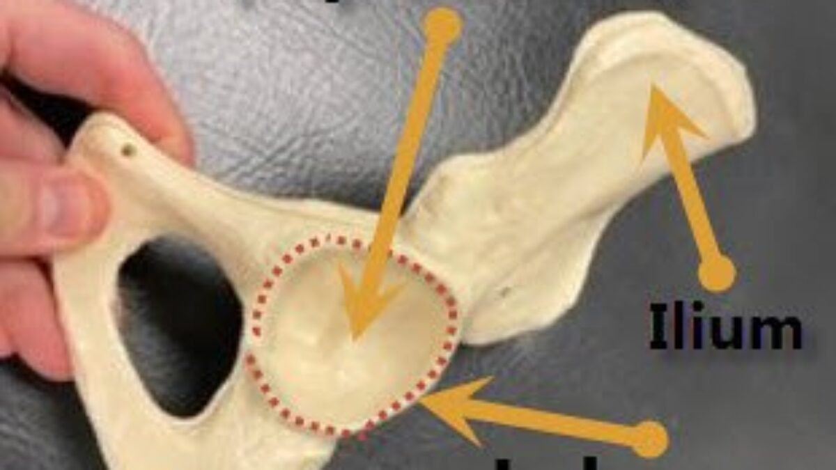 健康・医学 Fractures of the Acetabulum Fractures of the Acetabulum: 9783642754371: Medicine