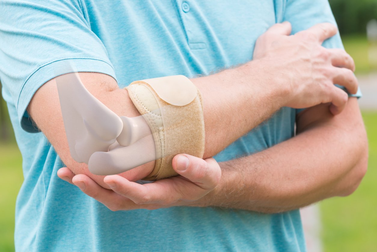 Man in blue holding his tennis elbow with an elbow brace for elbow pain treatments. JOI Rehab