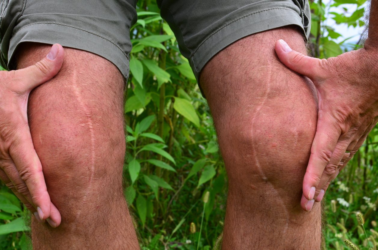Joint Pain Caused by the Weather 