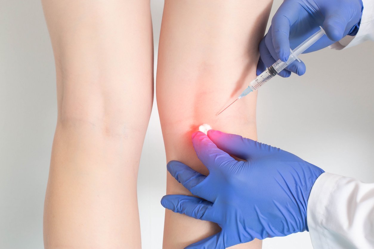 JOI Baker's Cyst 