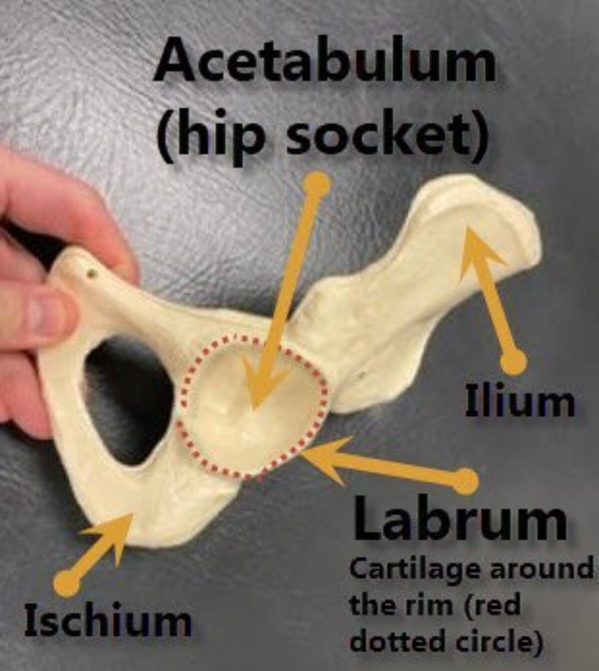 What Is Acetabular Labrum