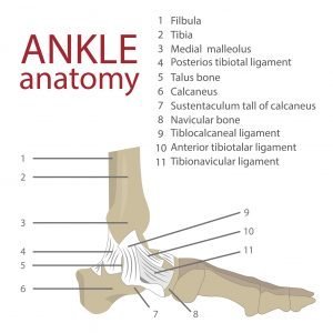 Symptoms of a sprained ankle or torn ligaments can be pain and swelling.